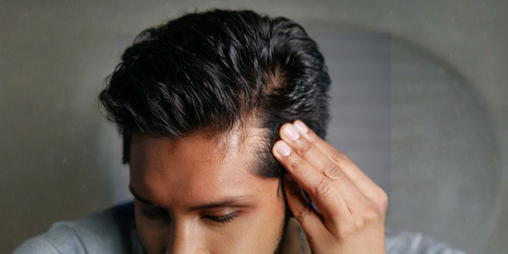 Hair-loss