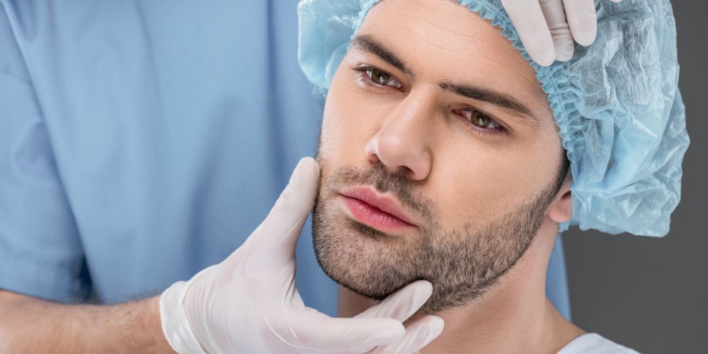 beard-transplant